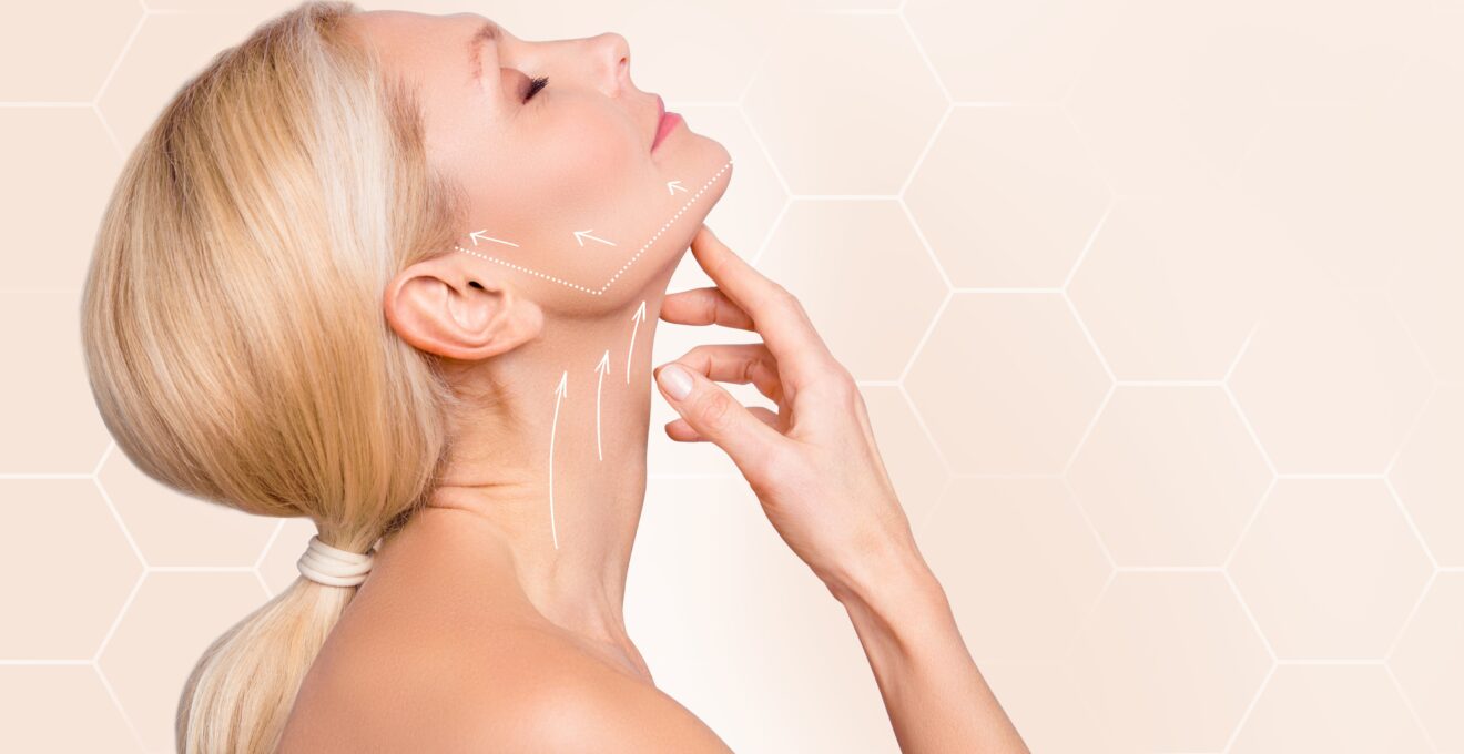 lifting cervico-facial
