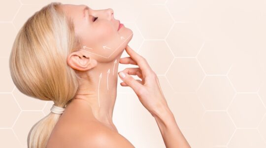 lifting cervico-facial